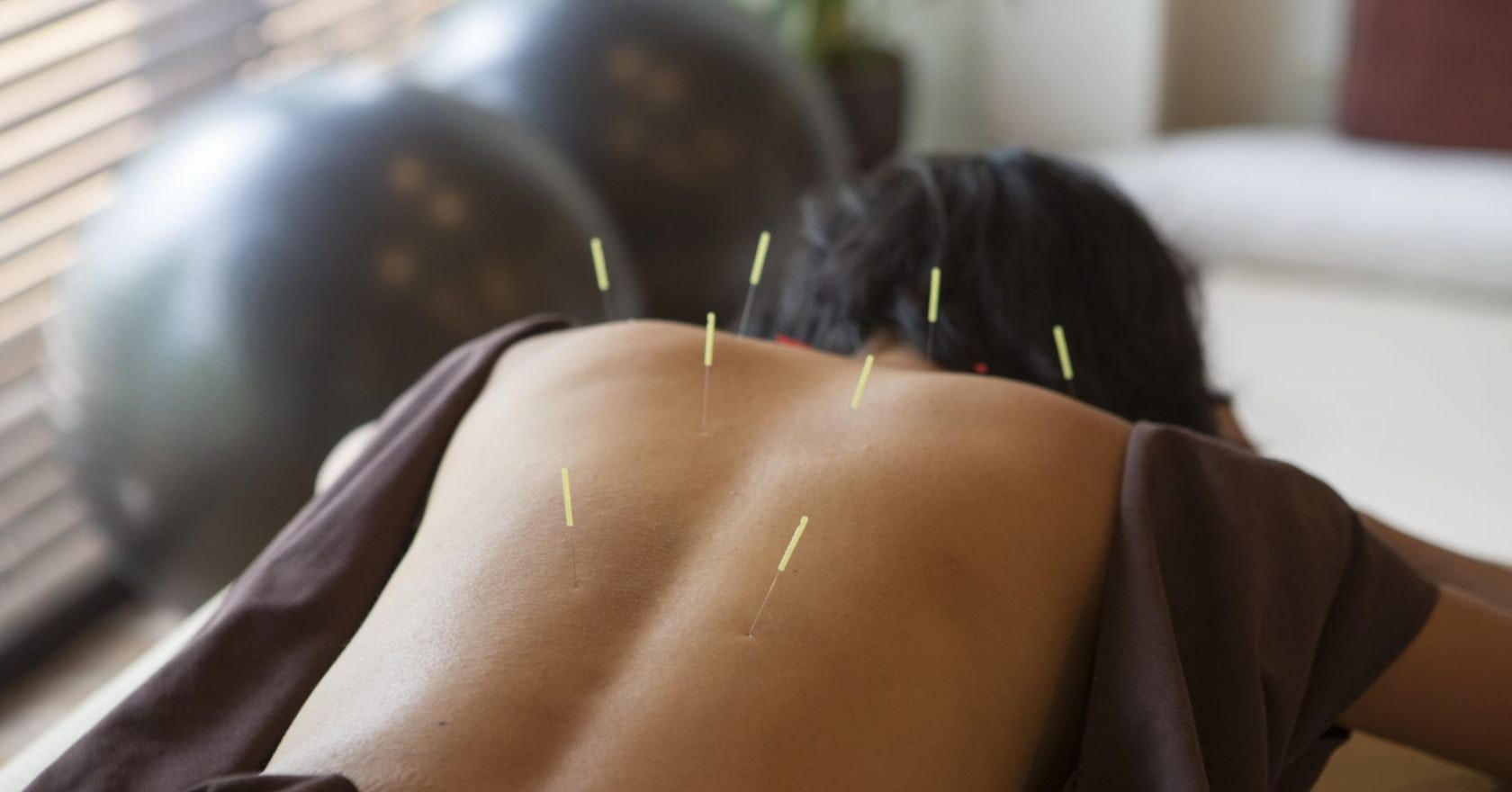 “I’ve just had the best period of my life – thanks to acupuncture”