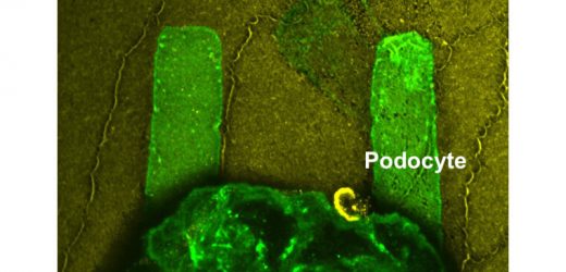 New technology offers pathways to finding treatments for kidney disease