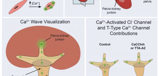 New therapeutics could help treat excess urine in the kidneys