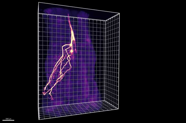 Scientists eavesdrop on communication between fat and brain