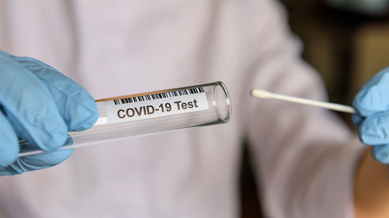 Two COVID Rapid Tests Accurately Diagnose Variant Infections