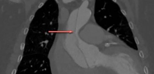 American man&apos;s hoarse throat turned out to be deadly heart condition