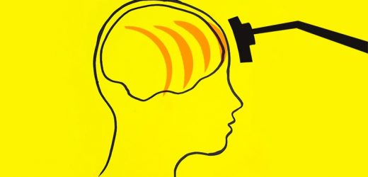 Comparing Prevention and Neurostimulation for Dementia