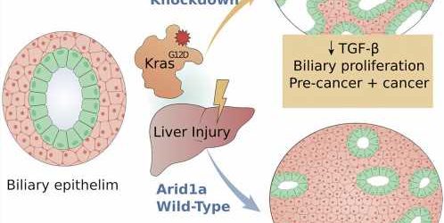 Deep in the bile ducts, researchers explore how cancer arises
