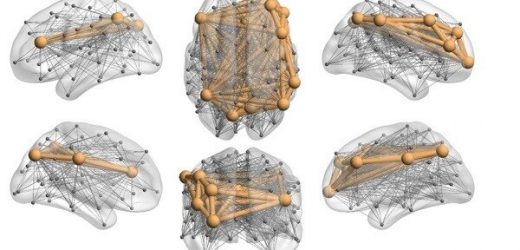 Effects of stress and coping strategies regarding COVID also depend on pre-pandemic state of brain networks
