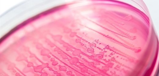 Male mice three times more likely than females to survive E. coli infection