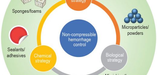 Non-compressible hemostatic materials: Design strategies, formulations, and challenges