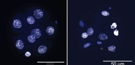 On the trail of missing genes and cancer clues