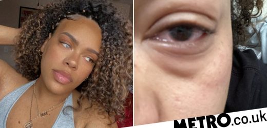 Parasite infects woman's eye after she washed contact lens case in water