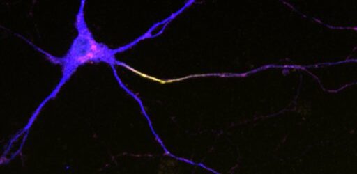 Secret of neuron’s shape revealed in study of worms, rodents, people