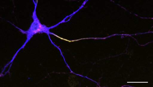 Secret of neuron’s shape revealed in study of worms, rodents, people