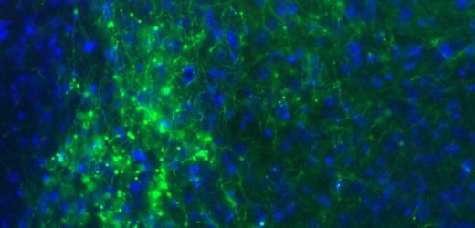 Secret structure in the wiring diagram of the brain
