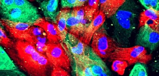 Shortened course of radiation therapy safe and effective for men with high-risk prostate cancer