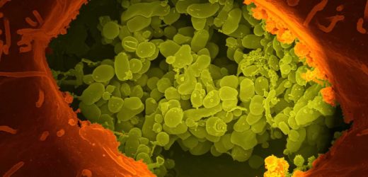 Some viruses that cause cancer suppress the immune system with help from common bacteria