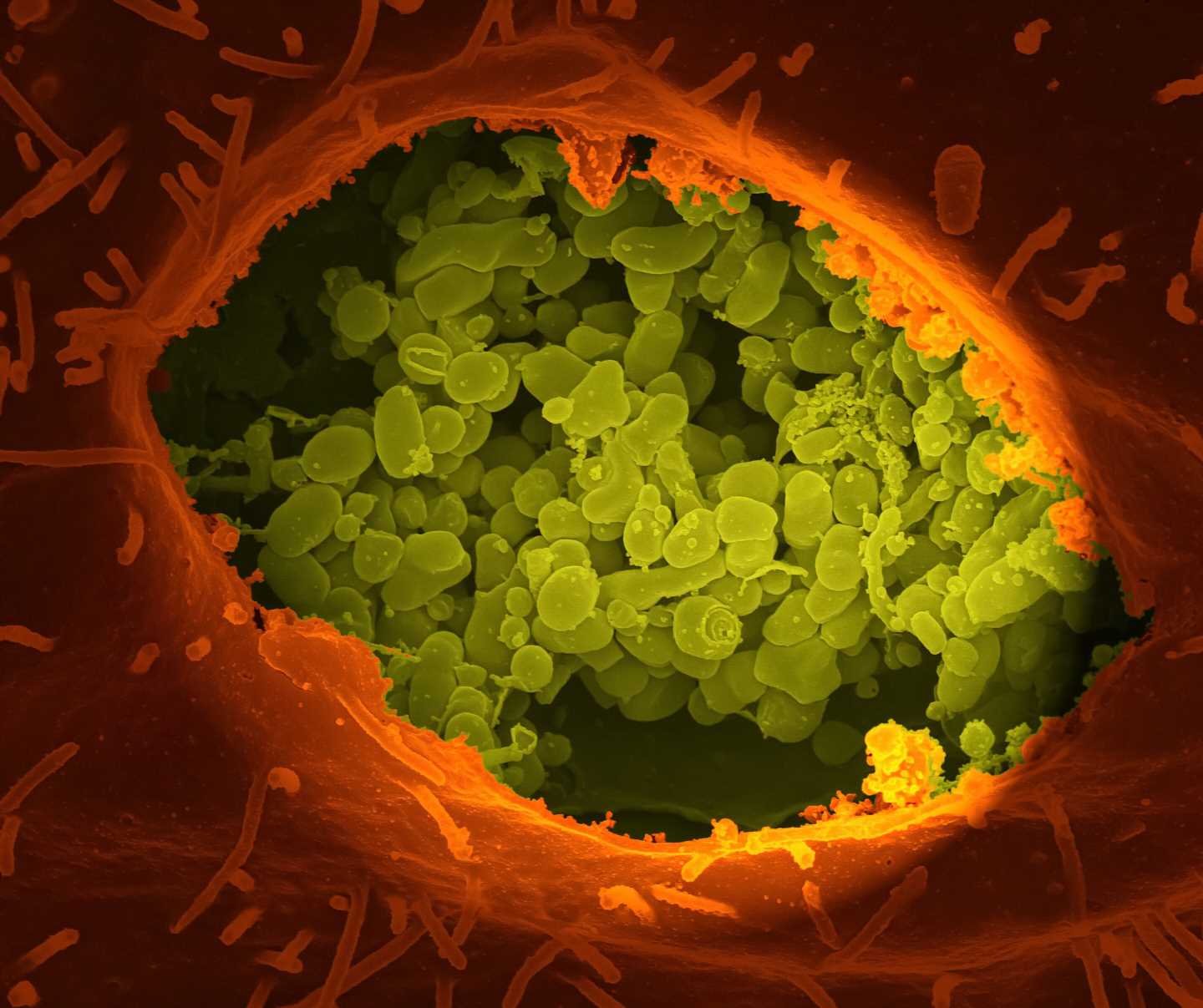 Some viruses that cause cancer suppress the immune system with help from common bacteria