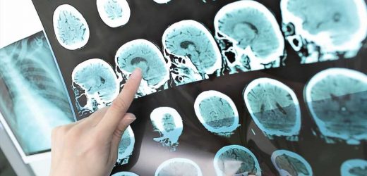 What are the genetic associations of stroke pathogenesis across ancestry groups?