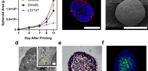 3D bioprinting platform replicates patient-specific tumors