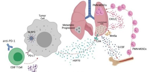 Biomarker predicts resistance to immunotherapies in melanoma