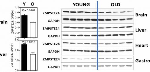 Exploring the role of lamin in normal aging