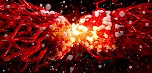 How AI Is, or Will Soon Be, Relevant in Radiation Oncology