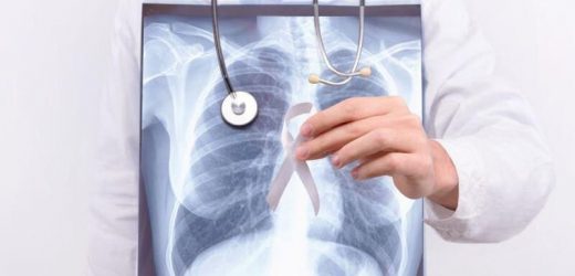 Top medical groups, hospitals urge better access to lung cancer screening