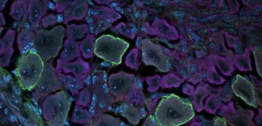 Using single-cell mass cytometry to explore the somatosensory system’s development