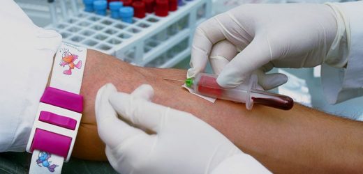 Wide Variance Described in Monitoring of Conventional DMARDs