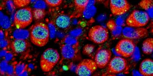 Beyond the brain: A link between hearing loss and autism spectrum disorder