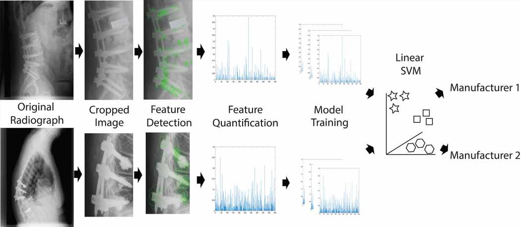 Computer vision is superior to surgeons in identifying spinal implants, shows study