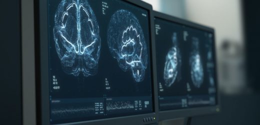 First cell-type specific multiomic study of the HIV brain