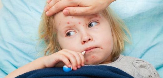 Measles outbreak in Ohio infects 82 kids, most of them unvaccinated