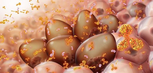 Multiple Myeloma Diagnosed More via Emergency Care During COVID