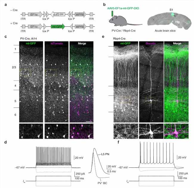 Myelin determines energy metabolism in inhibitory brain cells: Study