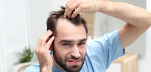 Nutritional supplements may have role in hair loss treatment