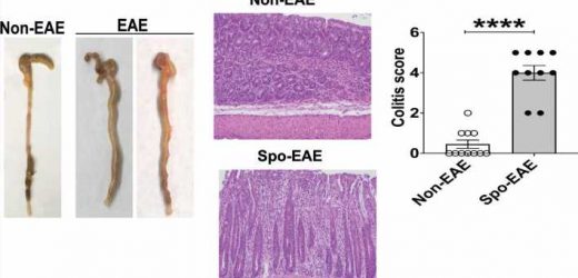 Poor gut health may drive multiple sclerosis—better diet may ease it