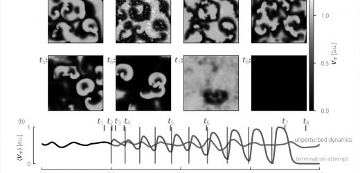Simulations show weak electrical pulses could treat atrial and ventricular fibrillations
