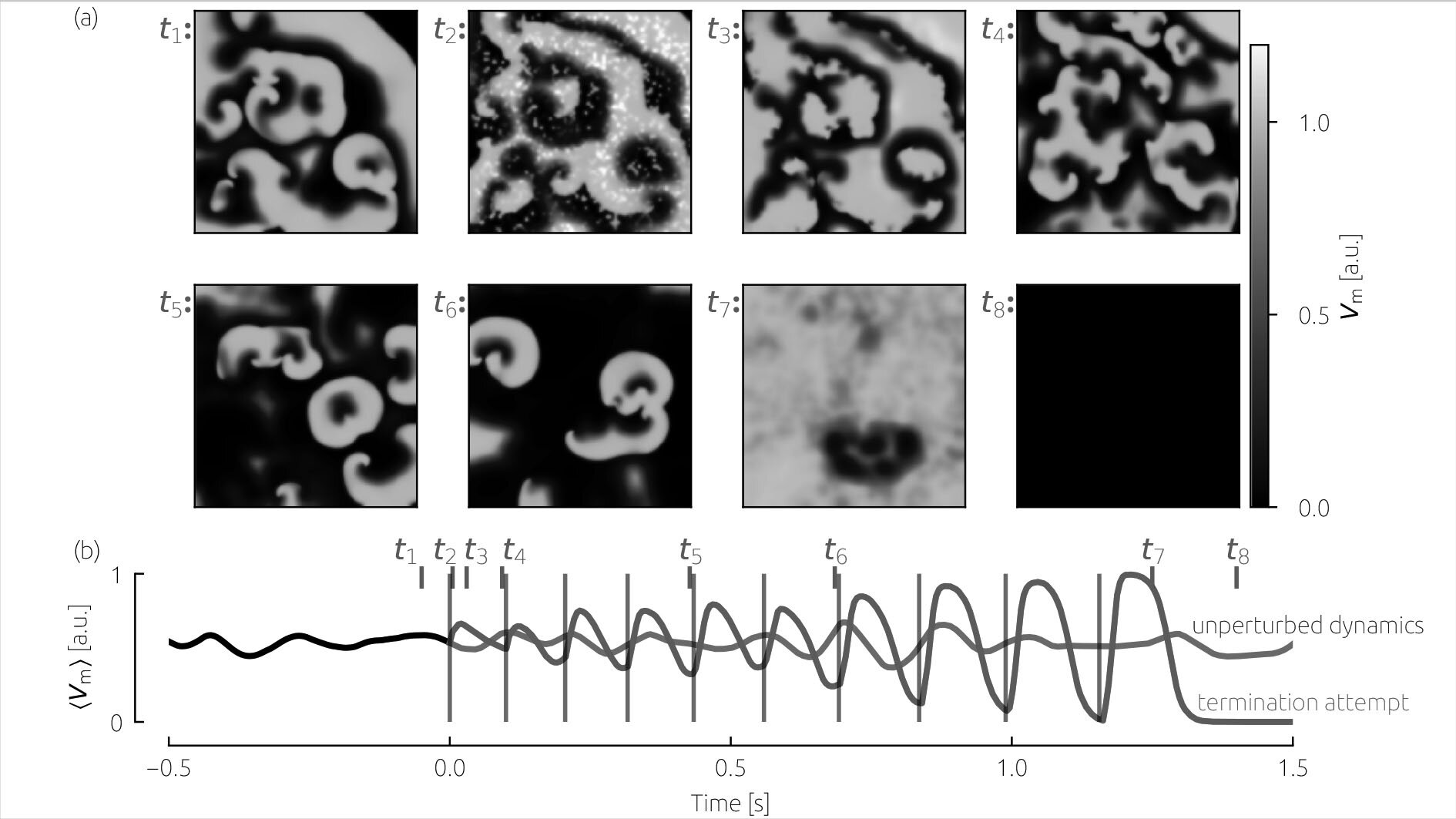 Simulations show weak electrical pulses could treat atrial and ventricular fibrillations