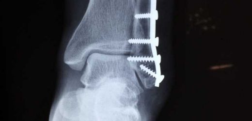 This winter, keep your balance to avoid the emergency room