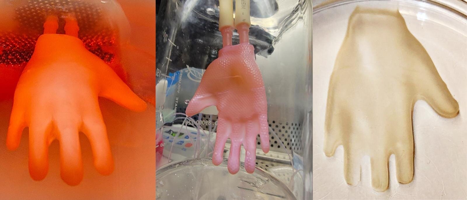 Bioengineered skin grafts that fit like gloves