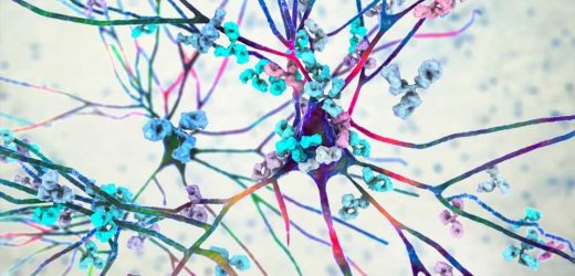 COVID-19 might increase risk of autoimmune diseases