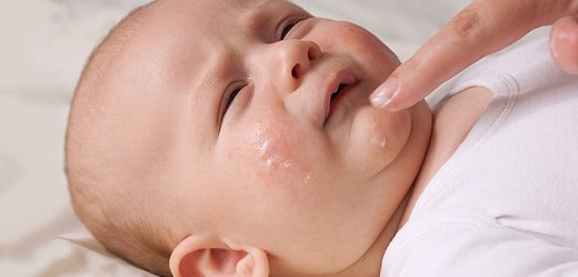 Cochrane Review Bolsters Case That Emollients Don’t Prevent AD