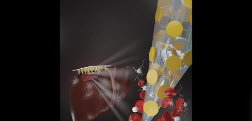 Novel microneedle bandage could save lives by stopping blood loss from wounds