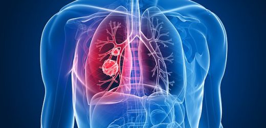 Only 1 PER CENT of Brits know deadly cancer symptoms, do YOU?