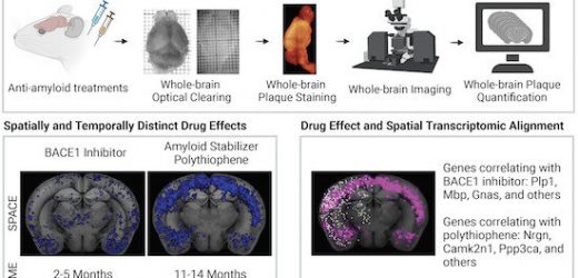 Professor uses tracer molecules to shine a light on Alzheimer’s research