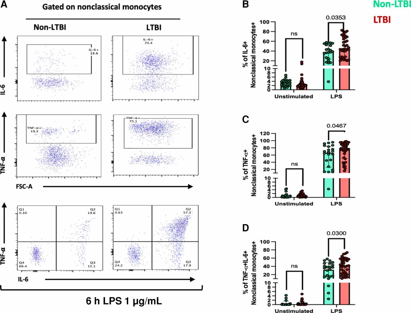 Research shows people with latent tuberculosis infection are more prone to inflammation