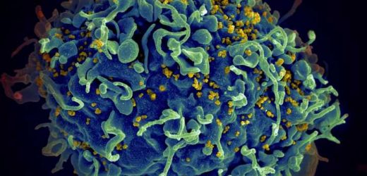 Scientists find potential cellular target for HIV therapies