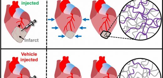 Scientists find way to heal scars left behind by heart attacks