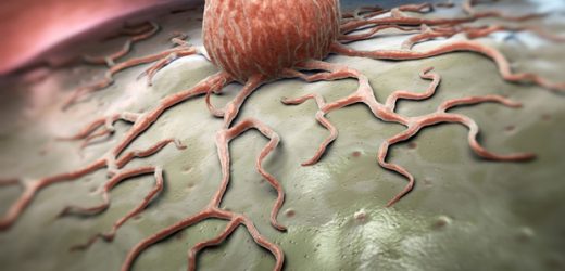 Study finds link between tumor microbiome and immune system in sarcoma patients