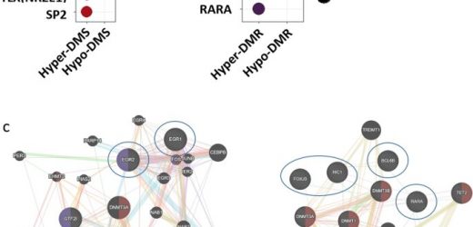 Study identifies a new cause of brain development disorders in Williams syndrome