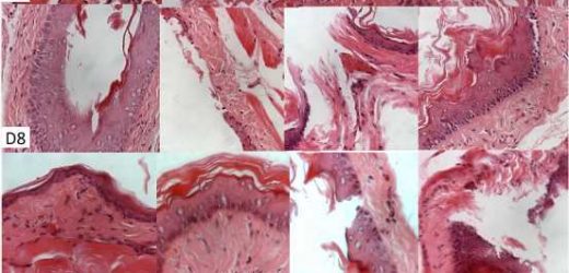 The chromatographic constitution of andiroba oil and its healing effects